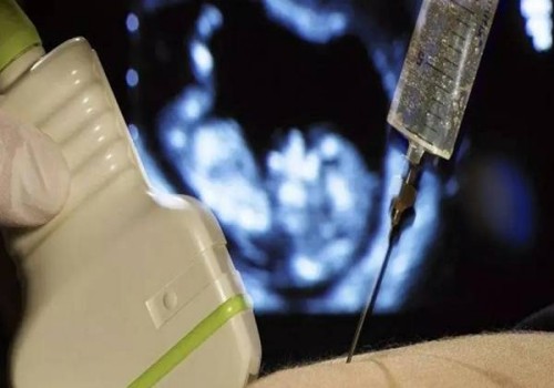 2022男性一旦患有輸精管堵塞會(huì)有哪些表現(xiàn)-