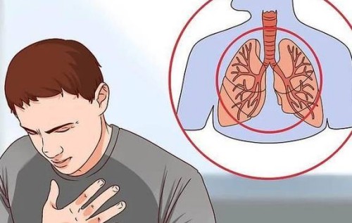 剖宮產(chǎn)后收腹帶需要戴多久？附佩戴時(shí)間及注意事項(xiàng)_1