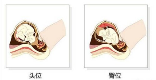 過來人分享艾灸治療月經(jīng)不調(diào)的效果，好不好一看便知