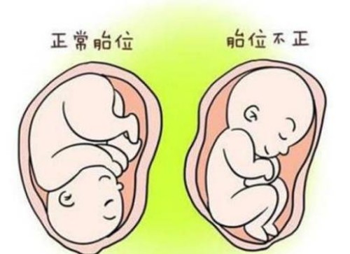 寧波助孕：三代篩查不合格仍然想要移植？能夠接受這些風(fēng)險就可以繼續(xù)