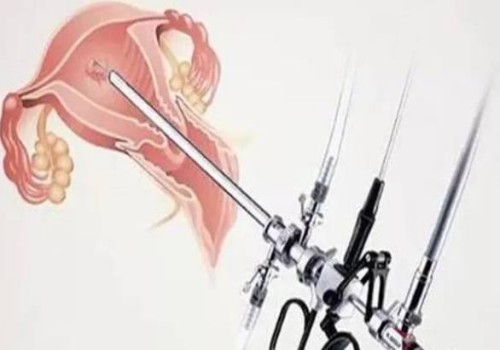 單身女性不要只看凍卵的利端，只要是手術(shù)就會有利弊