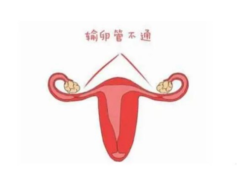 寧波助孕公司：備孕夫妻這樣做更容易懷孕，照這樣做讓你更快當爸媽