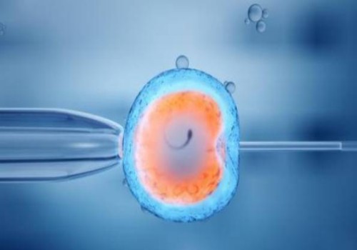 羊水穿刺染色體報(bào)告解讀：是男孩還是女孩一目了然！