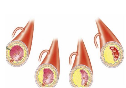 寧波供卵試管：超詳細的試管嬰兒移植全流程分享，從開始到成功只需要五步